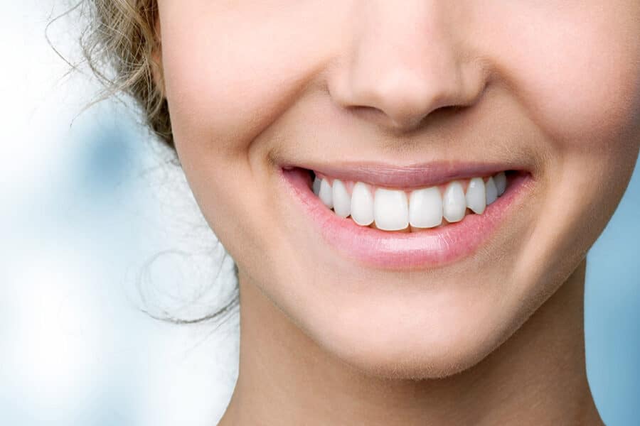 Professional Teeth Whitening - York County PA
