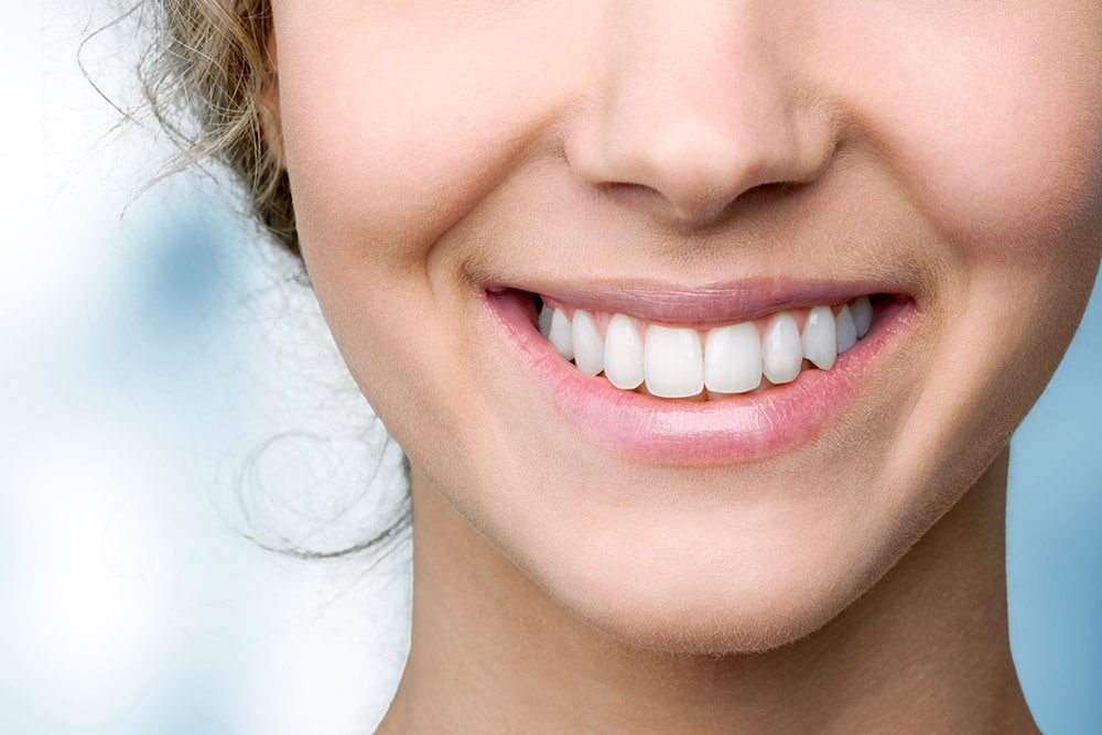 Professional Teeth Whitening Etters York Lewisberry Capozzi