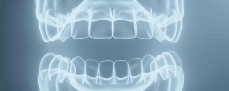 Dental XRay