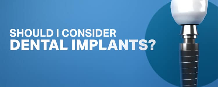 Dental Implant Banner