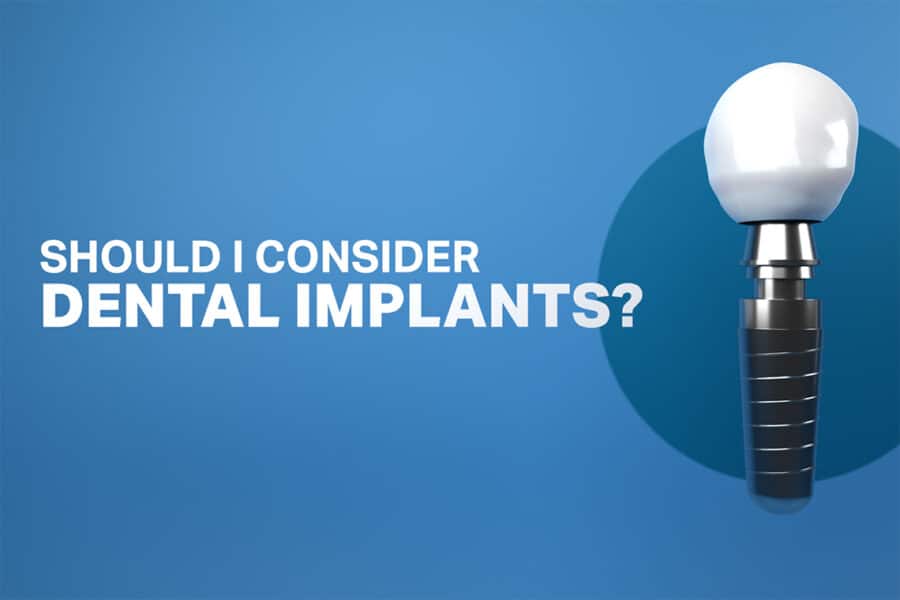 Dental Implant Banner